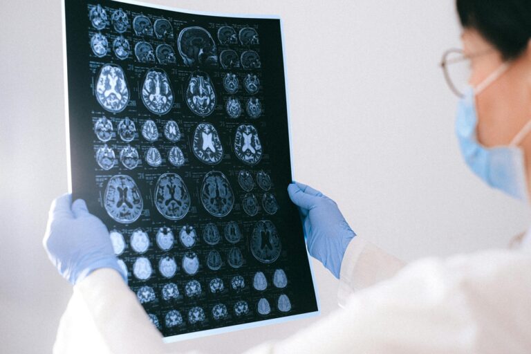 BrainAge: tecnologia indica a idade cerebral BrainAge: tecnologia indica a idade cerebral